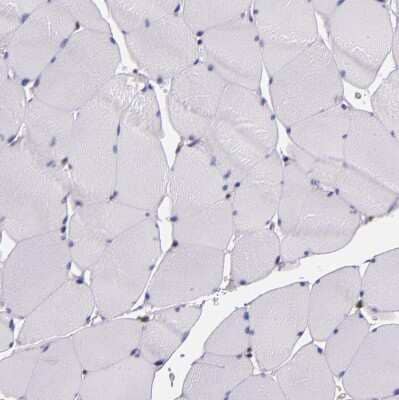 Immunohistochemistry-Paraffin: STAT6 Antibody [NBP1-85345]
