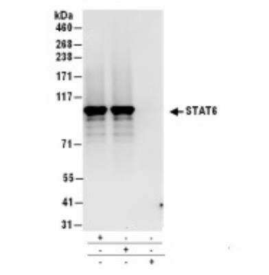 Immunoprecipitation: STAT6 Antibody [NB600-229]