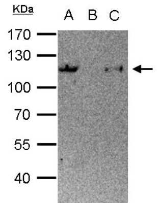 Immunoprecipitation: STAT6 Antibody [NBP2-20506]