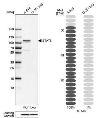 Western Blot: STAT6 Antibody [NBP1-85345]