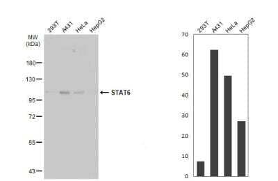 Western Blot: STAT6 Antibody [NBP2-20506]