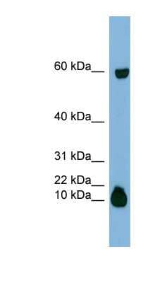 Western Blot: STATH Antibody [NBP1-58020]