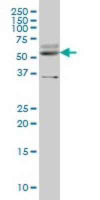 Western Blot: STAU2 Antibody (1B9) [H00027067-M04]