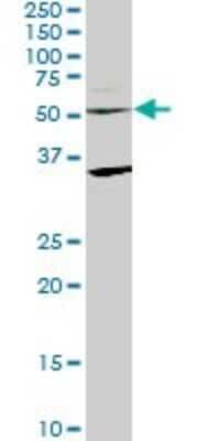 Western Blot: STAU2 Antibody (3E9) [H00027067-M09]