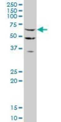 Western Blot: STAU2 Antibody (6F9) [H00027067-M03]