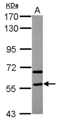 Western Blot: STAU2 Antibody [NBP2-20507]