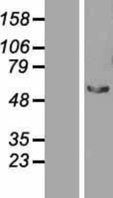 Western Blot: STAU2 Overexpression Lysate [NBP2-07346]