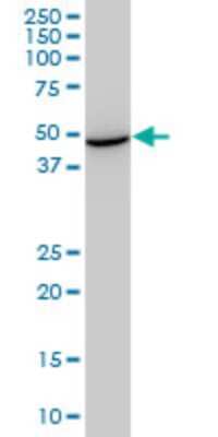 Western Blot: STCH Antibody (1H8) [H00006782-M02]