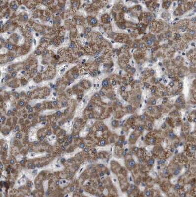 Immunohistochemistry-Paraffin: STCH Antibody [NBP1-80715]