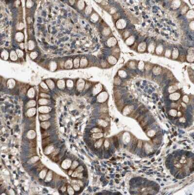 Immunohistochemistry-Paraffin: STCH Antibody [NBP1-80715]