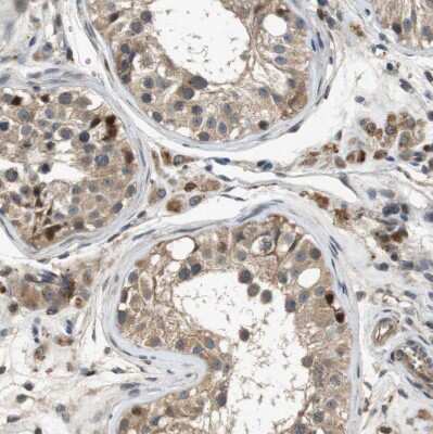 Immunohistochemistry-Paraffin: STCH Antibody [NBP1-80715]