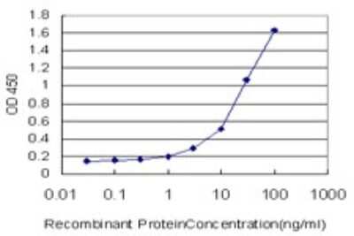 ELISA: STEAP1 Antibody (4F6-1F3) [H00026872-M01]