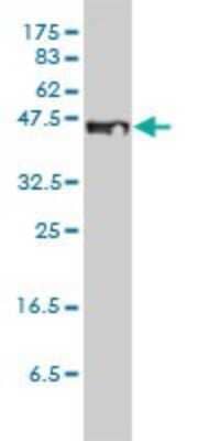 Western Blot: STEAP1 Antibody (4F6-1F3) [H00026872-M01]