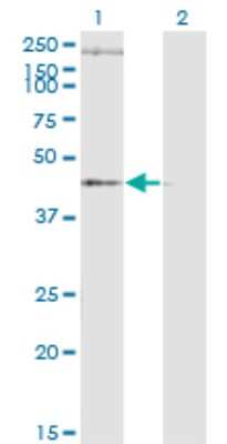 Western Blot: STEAP1 Antibody (4F6-1F3) [H00026872-M01]