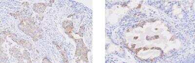 Immunohistochemistry-Paraffin: STEAP1 Antibody (J2D2) - BSA Free [NBP1-07094]