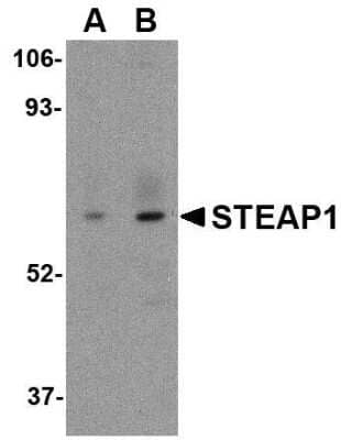 Western Blot: STEAP1 AntibodyBSA Free [NBP1-76821]