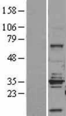 Western Blot: STEAP1 Overexpression Lysate [NBP2-04337]