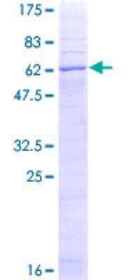 SDS-PAGE: Recombinant Human STEAP1 GST (N-Term) Protein [H00026872-P01]