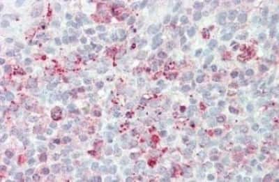 Immunohistochemistry-Paraffin: STEAP2 Antibody [NBP3-14486]