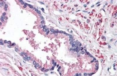 Immunohistochemistry-Paraffin: STEAP2 Antibody [NBP3-14487]