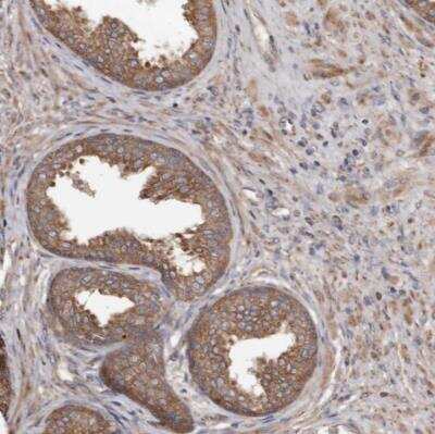 Immunohistochemistry-Paraffin: STEAP2 Antibody [NBP1-83100]