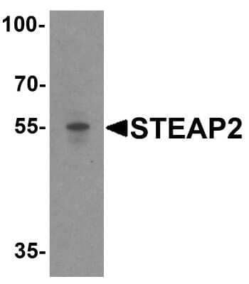 Western Blot: STEAP2 AntibodyBSA Free [NBP1-76823]