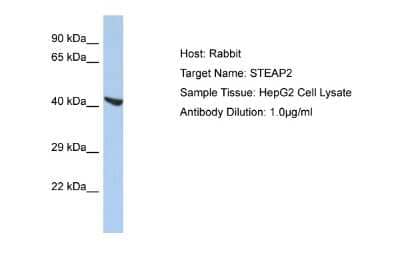 Western Blot: STEAP2 Antibody [NBP2-88370]