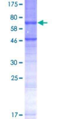 SDS-PAGE: Recombinant Human STEAP2 GST (N-Term) Protein [H00261729-P01]