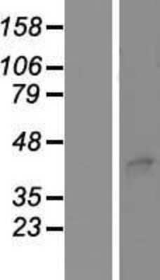 Western Blot: STEAP3/TSAP6 Overexpression Lysate [NBP2-06848]