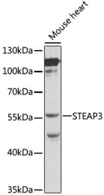 Western Blot: STEAP3/TSAP6 AntibodyBSA Free [NBP2-95115]