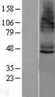 Western Blot: STAMP2/STEAP4 Overexpression Lysate [NBL1-16537]