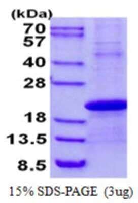 SDS-PAGE: Recombinant Human Stella/Dppa3 His Protein [NBP2-22997]