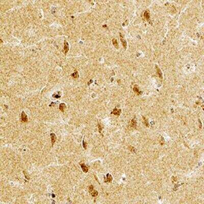 Immunohistochemistry-Paraffin: STEP Antibody (23E5) [NB300-202]