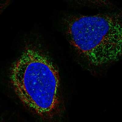 Immunocytochemistry/ Immunofluorescence: STEP Antibody [NBP2-58008]