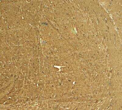 Immunohistochemistry: STEP Antibody - BSA Free [NBP2-81893]