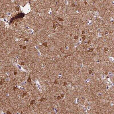 Immunohistochemistry-Paraffin: STEP Antibody [NBP1-87186]