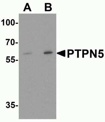 Western Blot: STEP AntibodyBSA Free [NBP2-81893]