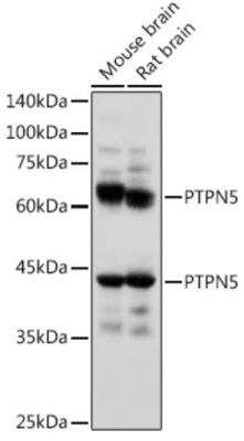 Western Blot: STEP AntibodyAzide and BSA Free [NBP3-03693]