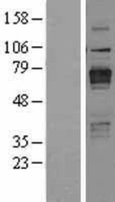 Western Blot: STEP Overexpression Lysate [NBL1-14975]