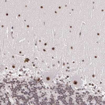 Immunohistochemistry-Paraffin: STG Antibody [NBP1-90660]