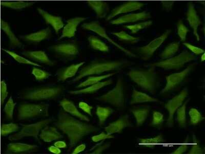 Immunocytochemistry/ Immunofluorescence: STI1 Antibody (1C6) [H00010963-M06]