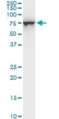 Western Blot: STI1 Antibody (1C6) [H00010963-M06]