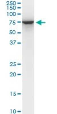 Western Blot: STI1 Antibody (1C6) [H00010963-M06]