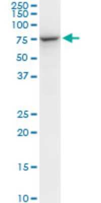 Western Blot: STI1 Antibody (1C6) [H00010963-M06]