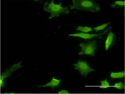 Immunocytochemistry/ Immunofluorescence: STI1 Antibody (2E1) [H00010963-M33]