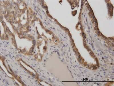 Immunohistochemistry-Paraffin: STI1 Antibody (2E1) [H00010963-M33]