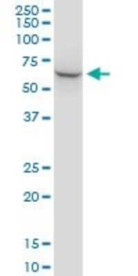 Western Blot: STI1 Antibody (2E11) [H00010963-M35]