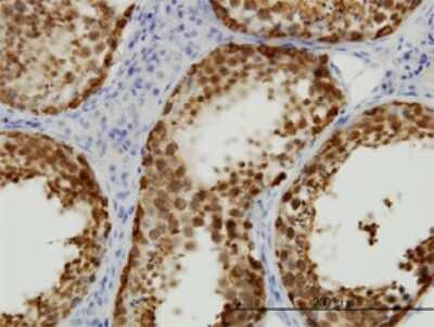 Immunohistochemistry-Paraffin: STI1 Antibody (4B6) [H00010963-M01]