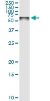 Immunoprecipitation: STI1 Antibody (4B6) [H00010963-M01]