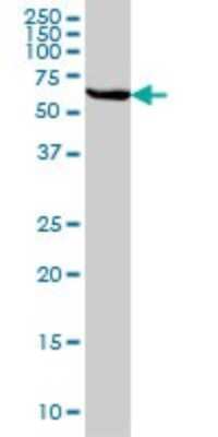 Western Blot: STI1 Antibody (4B6) [H00010963-M01]